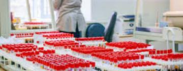 В Україні за добу зафіксовано 392 нові випадки. 